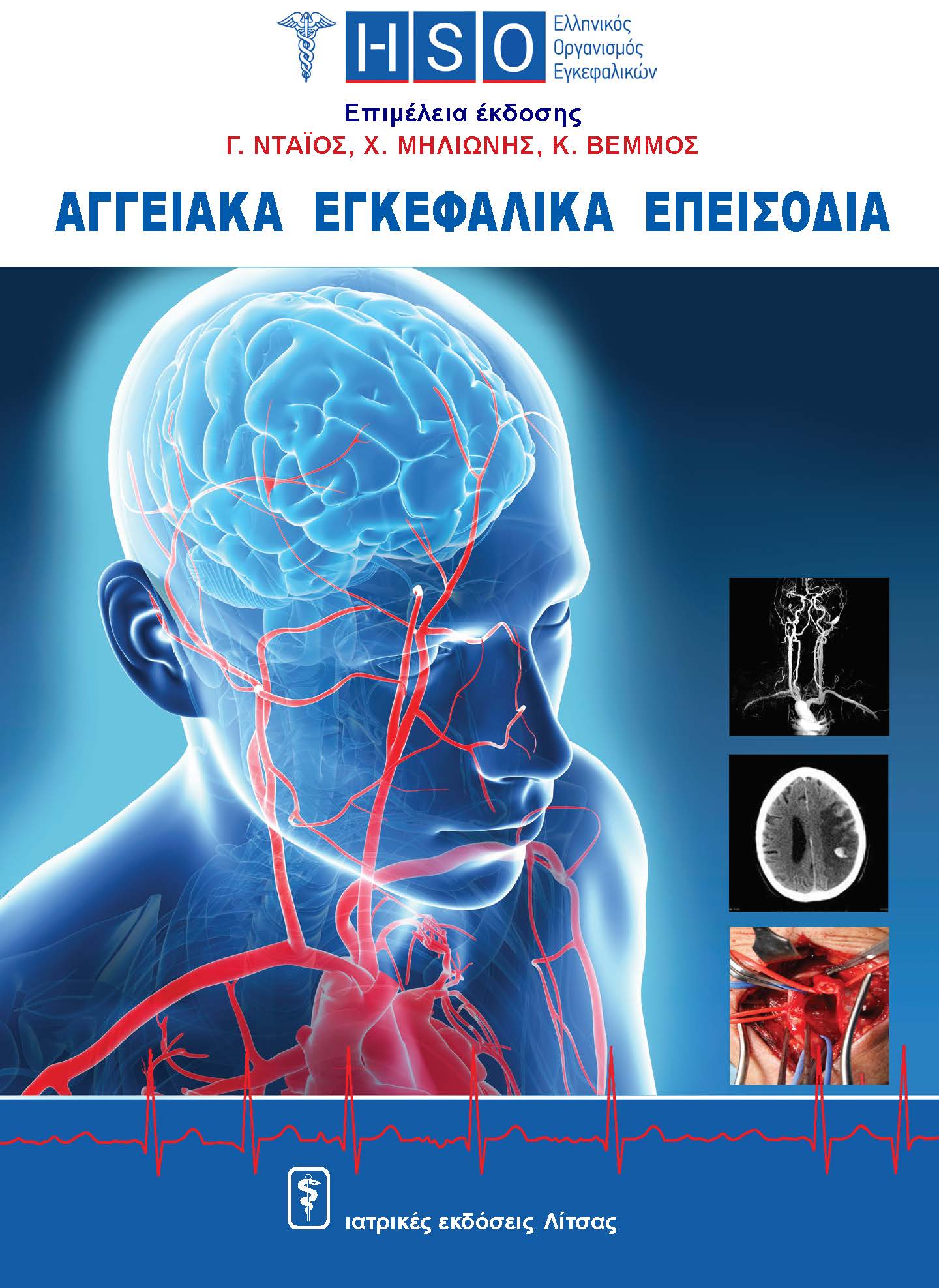 Εξώφυλλο βιβλιού Αγγειακά Εγκεφαλικά Επεισόδια